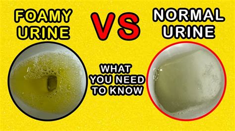 foamy pee after ejaculation|Foamy Urine: What’s Normal, What’s Not.